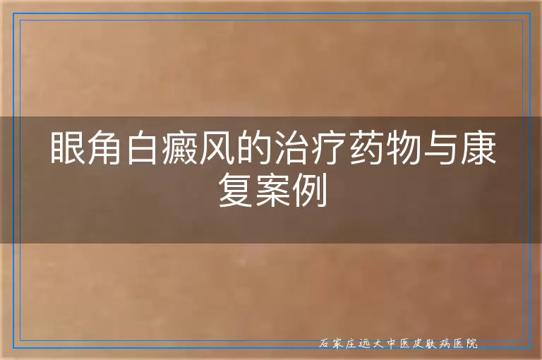 眼角白癜风的治疗药物与康复案例