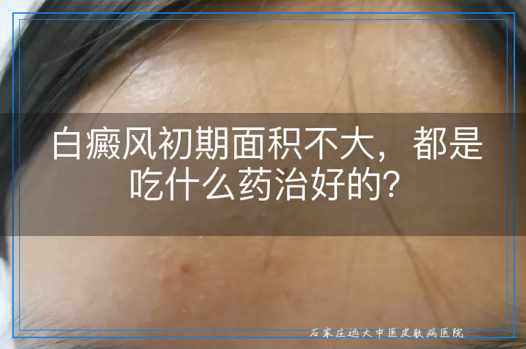 白癜风初期面积不大，都是吃什么药治好的？