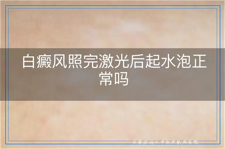 白癜风照完激光后起水泡正常吗