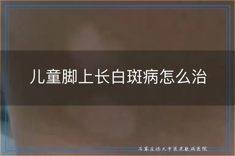 儿童脚上长白斑病怎么治