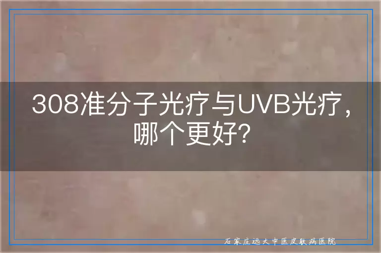 308准分子光疗与UVB光疗，哪个更好？