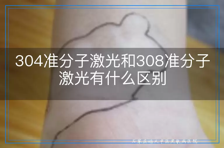 304准分子激光和308准分子激光有什么区别