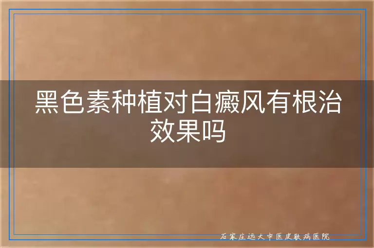 黑色素种植对白癜风有根治效果吗