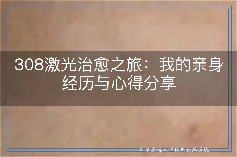 308激光治愈之旅：我的亲身经历与心得分享