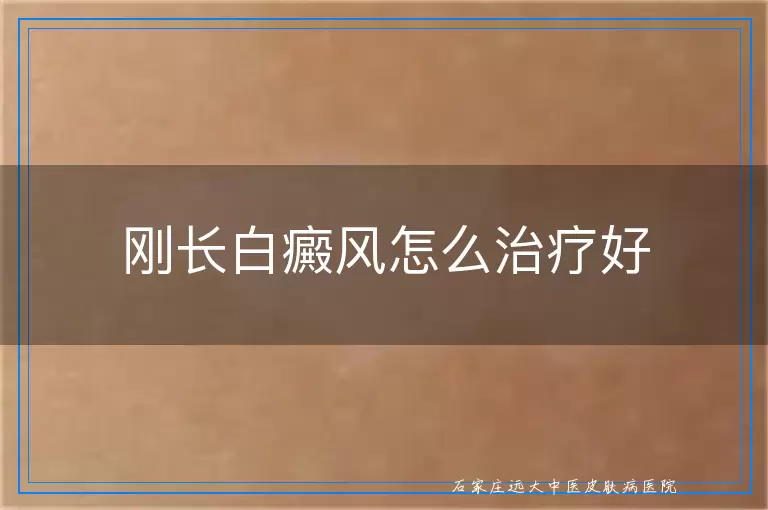 刚长白癜风怎么治疗好