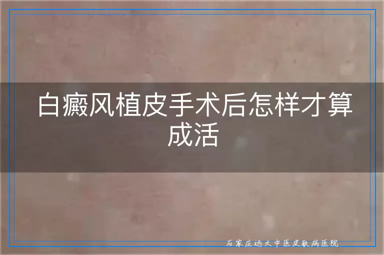 白癜风植皮手术后怎样才算成活