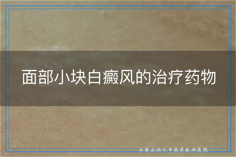 面部小块白癜风的治疗药物