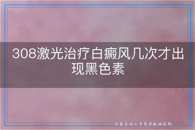 308激光治疗白癜风几次才出现黑色素