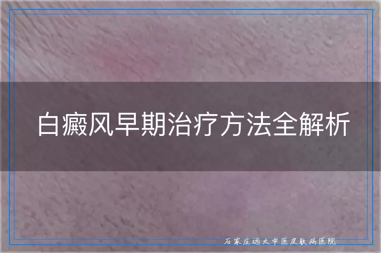 白癜风早期治疗方法全解析
