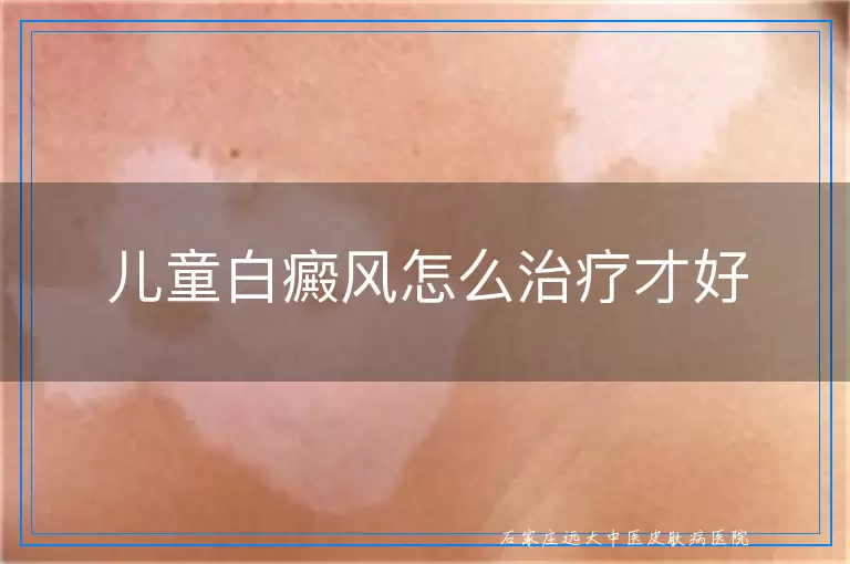 儿童白癜风怎么治疗才好