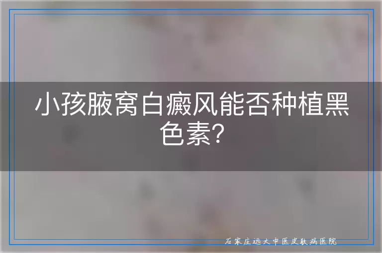 小孩腋窝白癜风能否种植黑色素？