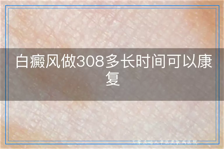 白癜风做308多长时间可以康复