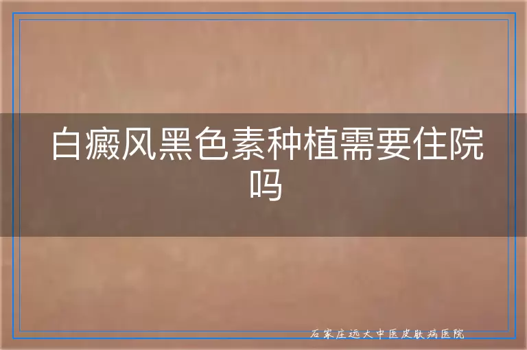 白癜风黑色素种植需要住院吗