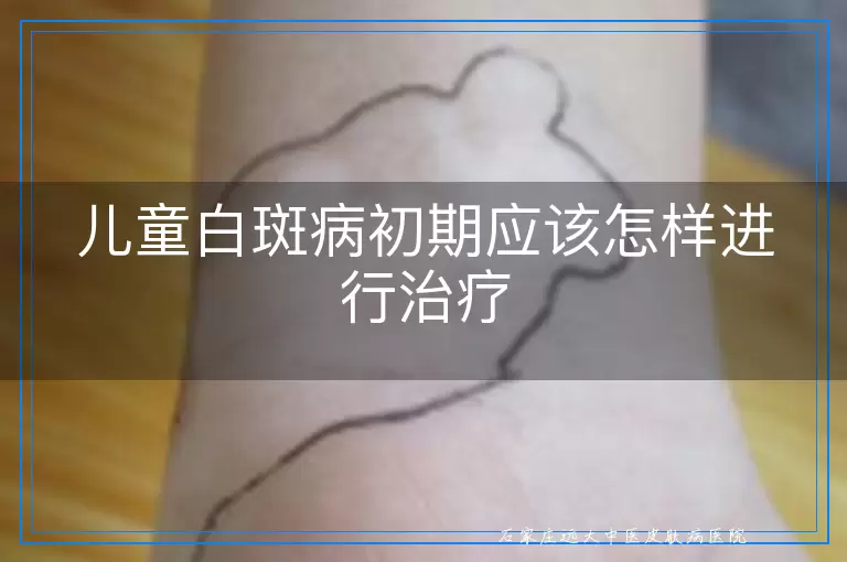 儿童白斑病初期应该怎样进行治疗
