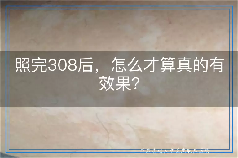 照完308后，怎么才算真的有效果？