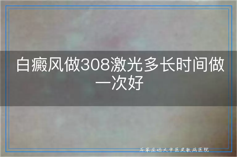 白癜风做308激光多长时间做一次好