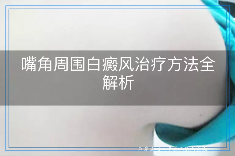 嘴角周围白癜风治疗方法全解析