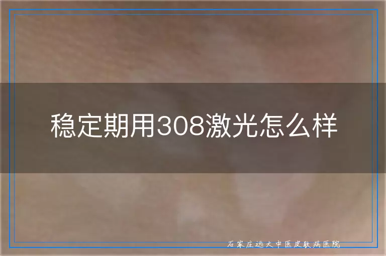 稳定期用308激光怎么样