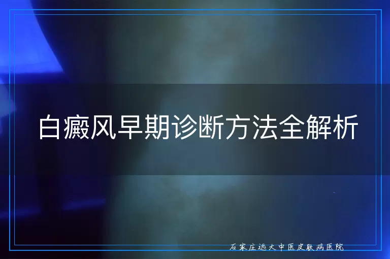 白癜风早期诊断方法全解析
