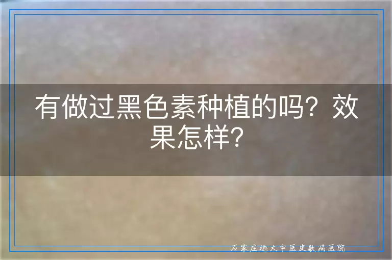 有做过黑色素种植的吗？效果怎样？