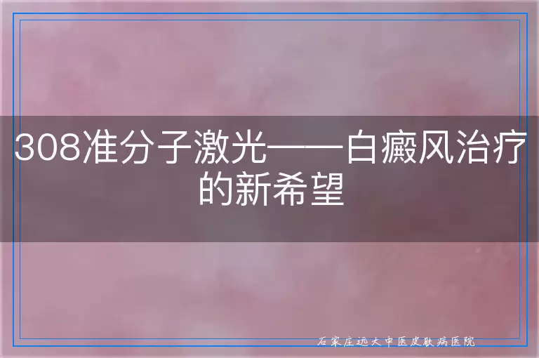 308准分子激光——白癜风治疗的新希望