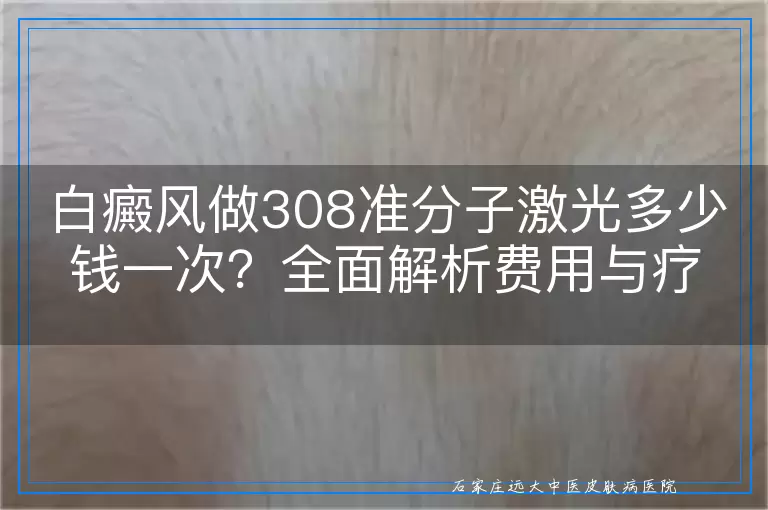 白癜风做308准分子激光多少钱一次？全面解析费用与疗效