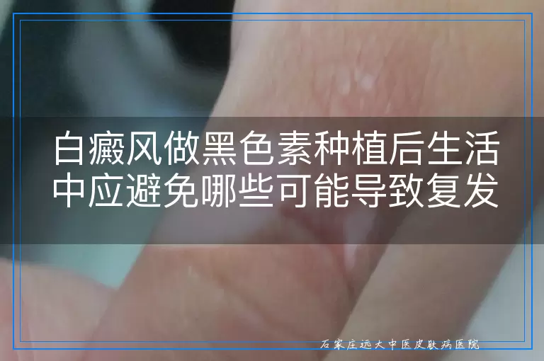 白癜风做黑色素种植后生活中应避免哪些可能导致复发的因素
