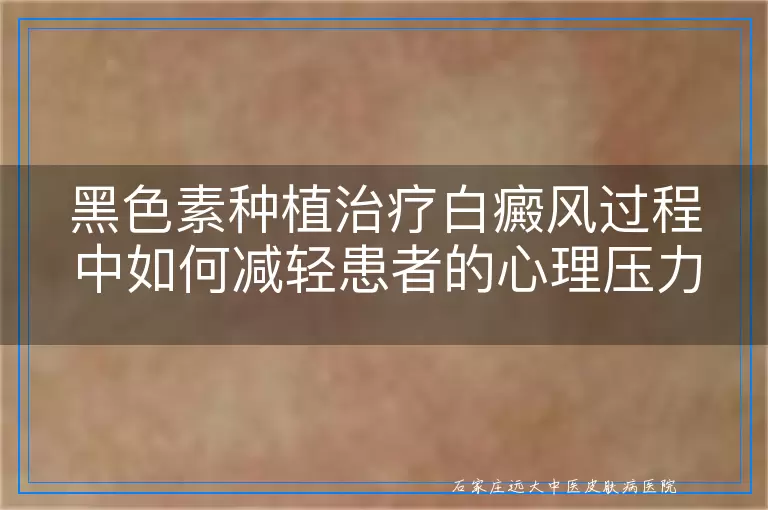 黑色素种植治疗白癜风过程中如何减轻患者的心理压力