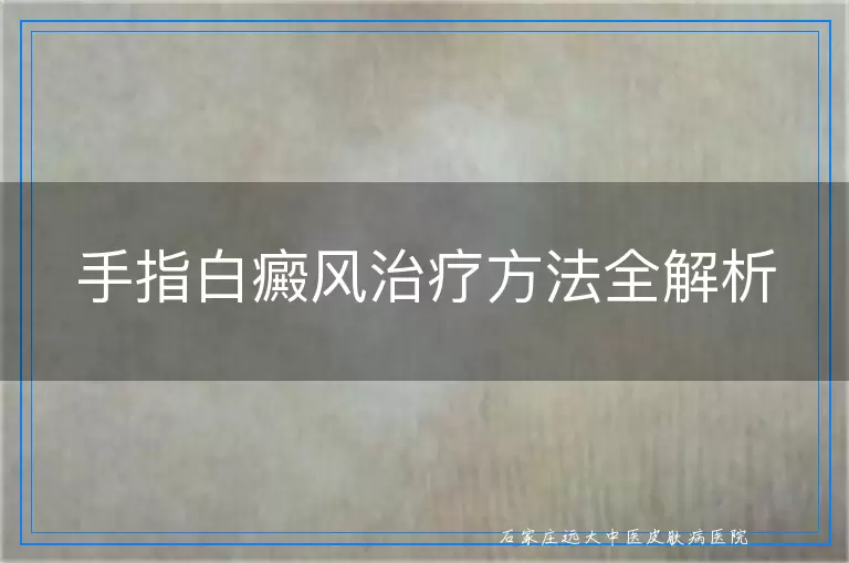 手指白癜风治疗方法全解析