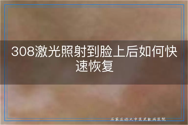 308激光照射到脸上后如何快速恢复
