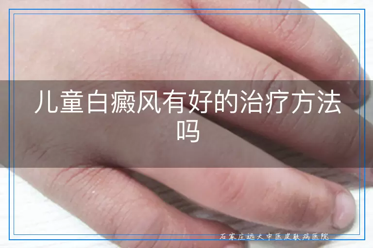 儿童白癜风有好的治疗方法吗