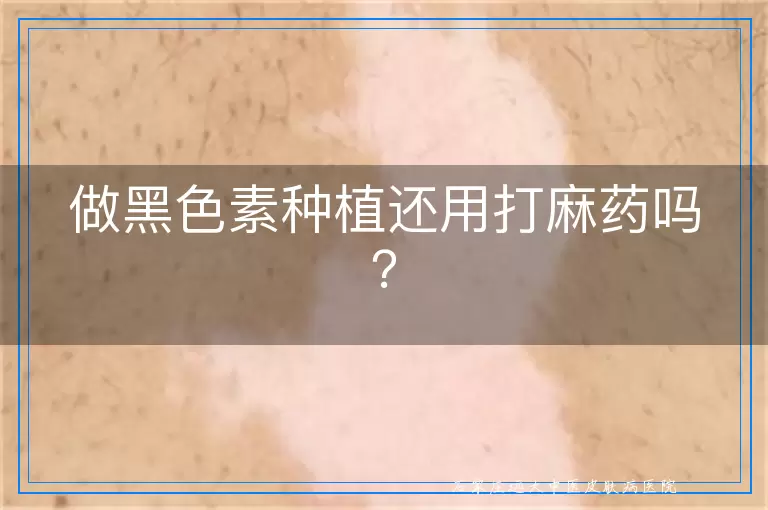 做黑色素种植还用打麻药吗？