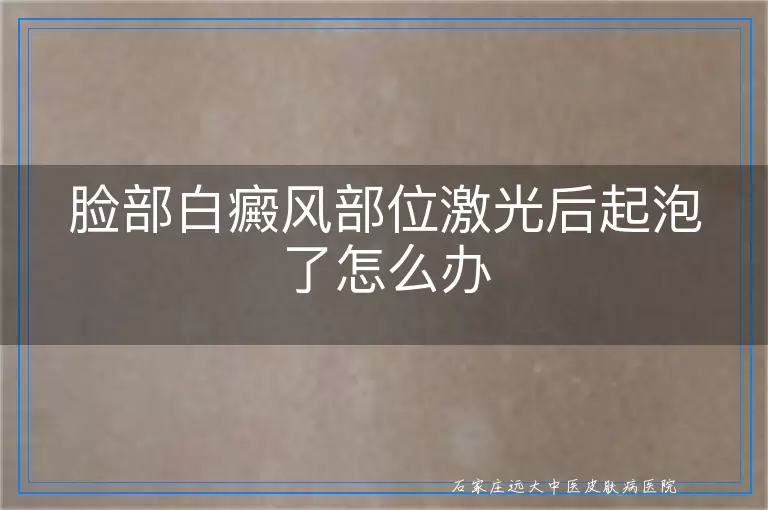 脸部白癜风部位激光后起泡了怎么办