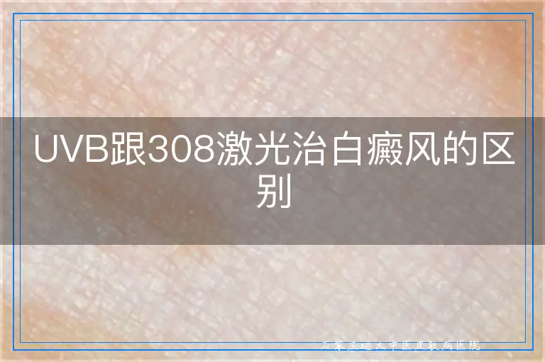 UVB跟308激光治白癜风的区别