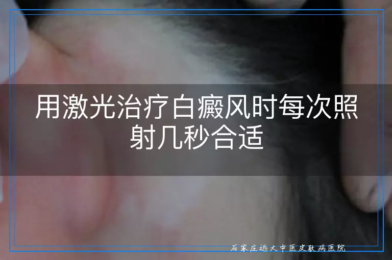 用激光治疗白癜风时每次照射几秒合适