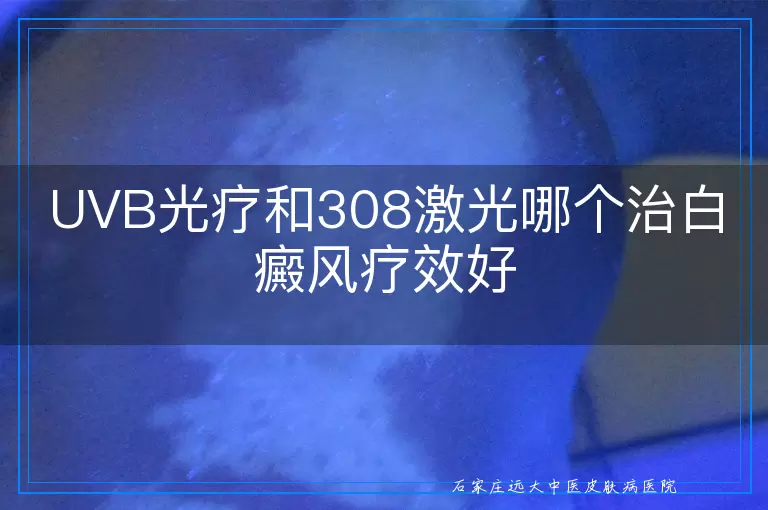 UVB光疗和308激光哪个治白癜风疗效好