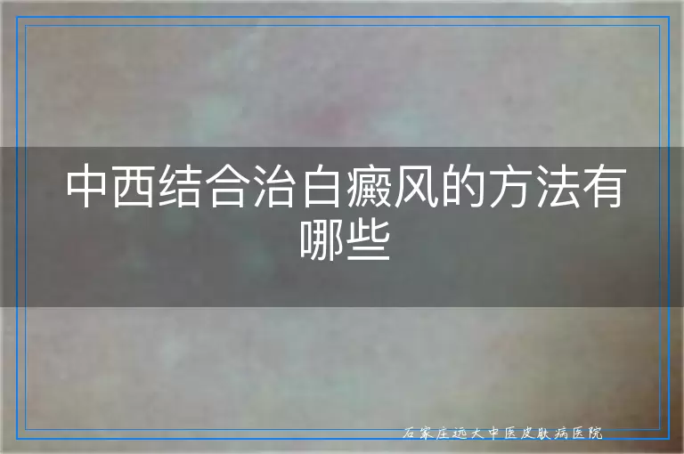 中西结合治白癜风的方法有哪些