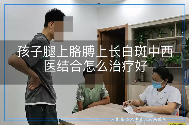 孩子腿上胳膊上长白斑中西医结合怎么治疗好