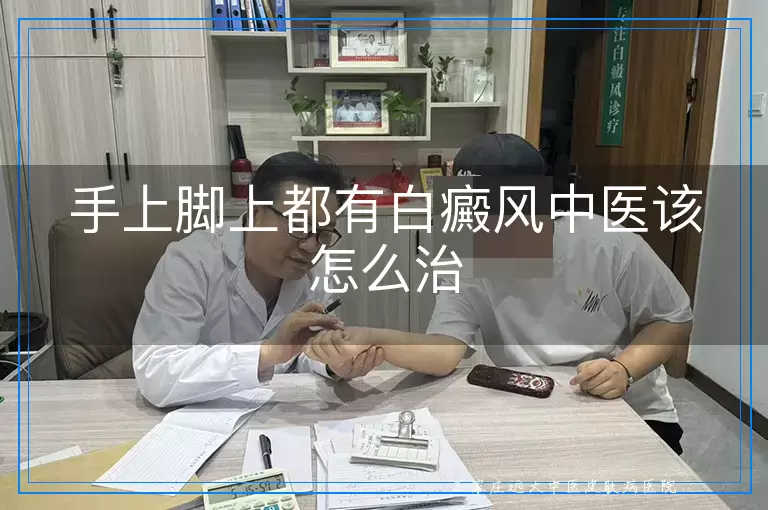 手上脚上都有白癜风中医该怎么治