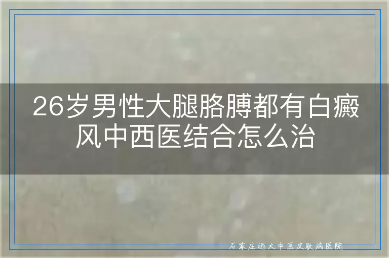 26岁男性大腿胳膊都有白癜风中西医结合怎么治