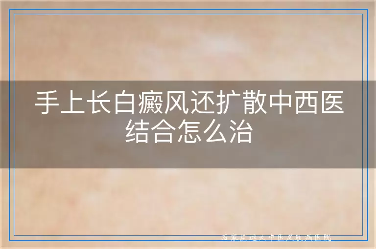 手上长白癜风还扩散中西医结合怎么治
