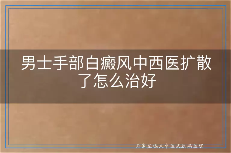 男士手部白癜风中西医扩散了怎么治好