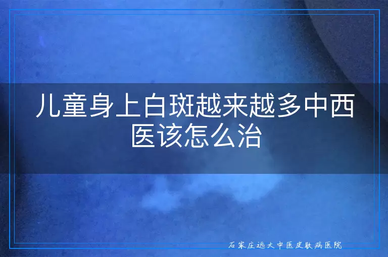儿童身上白斑越来越多中西医该怎么治
