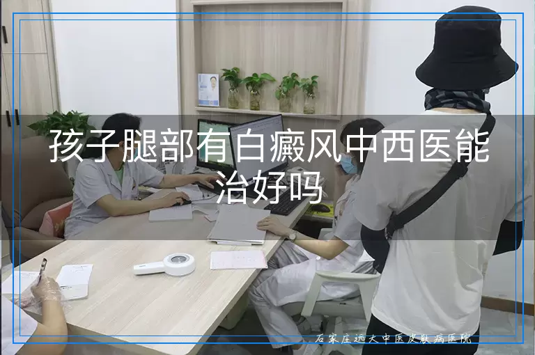 孩子腿部有白癜风中西医能治好吗