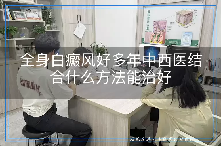 全身白癜风好多年中西医结合什么方法能治好