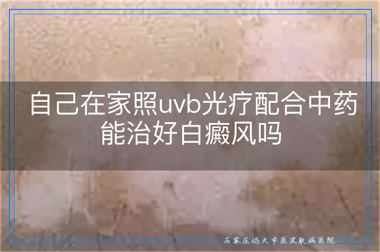 自己在家照uvb光疗配合中药能治好白癜风吗