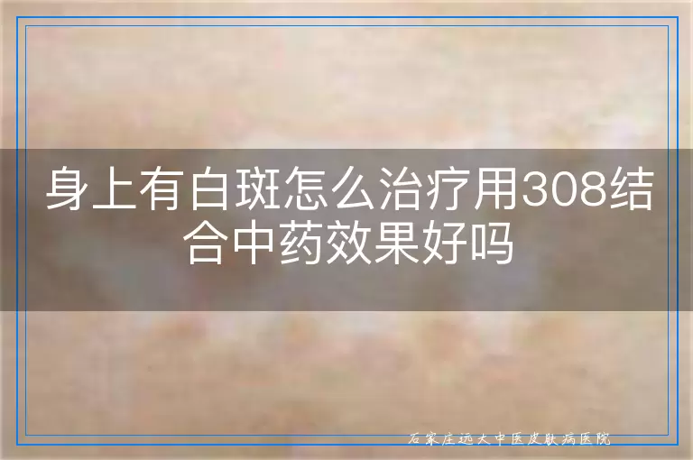 身上有白斑怎么治疗用308结合中药效果好吗