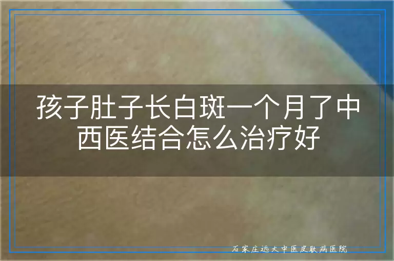 孩子肚子长白斑一个月了中西医结合怎么治疗好