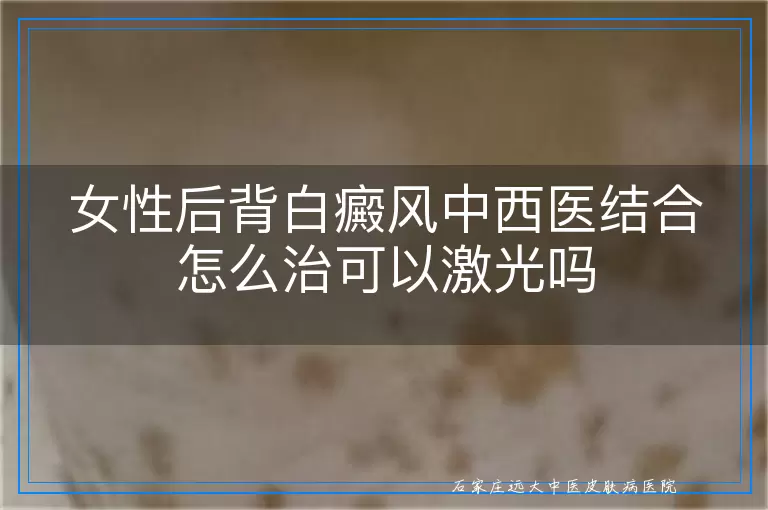 女性后背白癜风中西医结合怎么治可以激光吗
