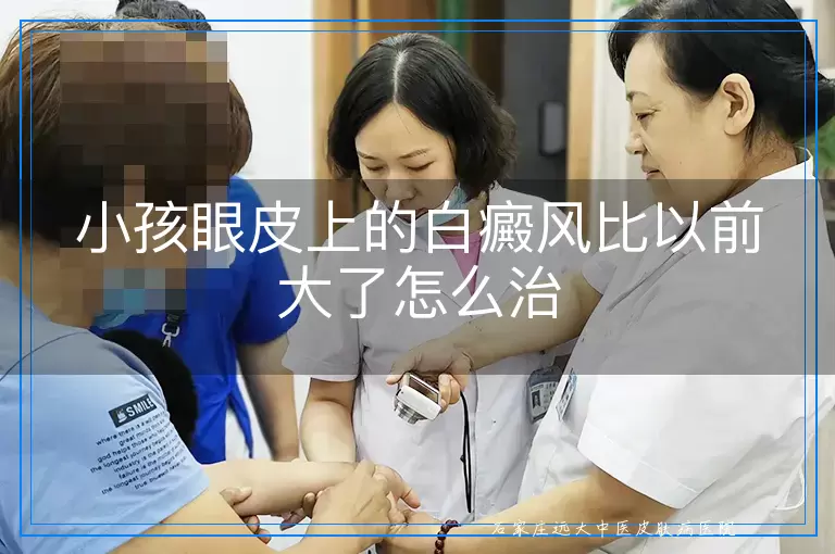 小孩眼皮上的白癜风比以前大了怎么治